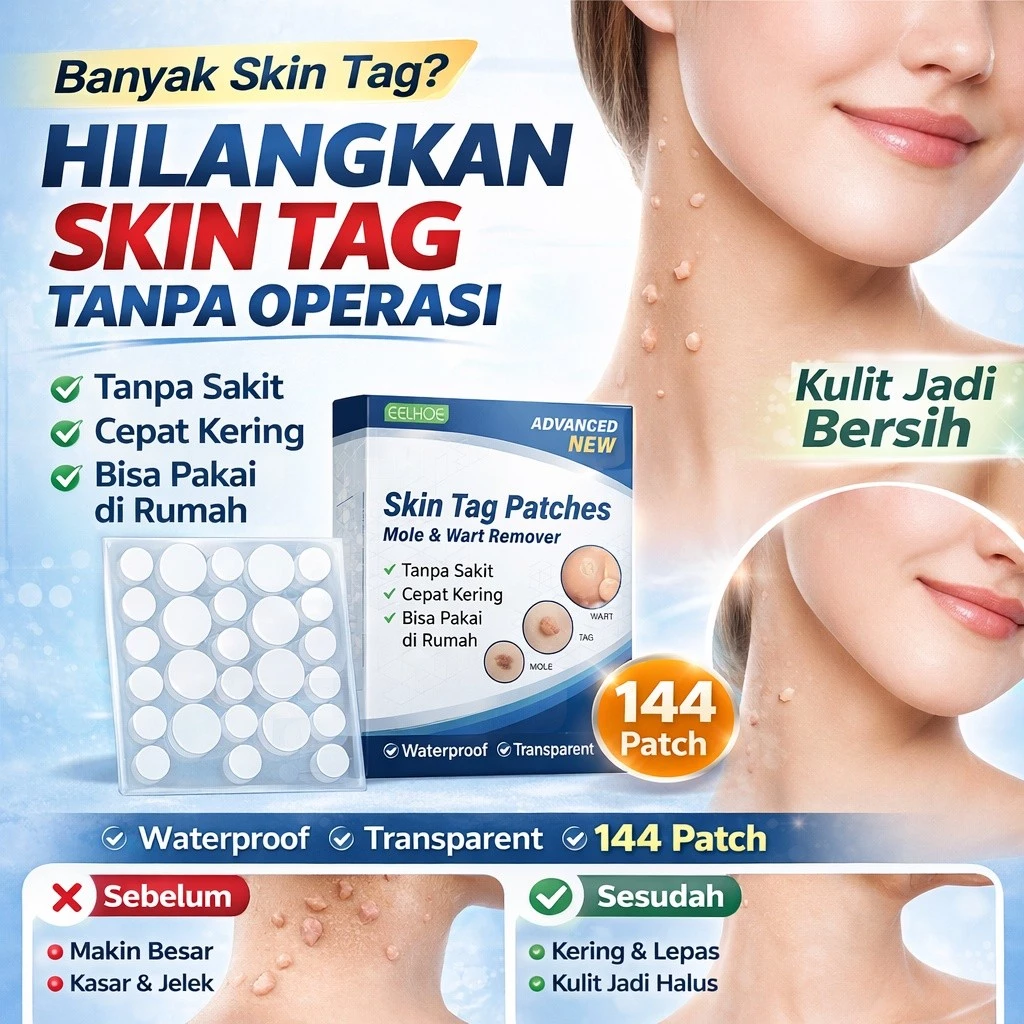 Skin Patch